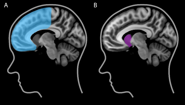 Figuur 1 – De belangrijkste gebieden voor feedback leren in onze hersenen zijn (A) de frontale cortex en (B) het striatum (afbeeldingen van de hersenen gebaseerd op het MNI standaardbrein uit de FSL toolbox; Jenkinson et al. (2012), Smith et al. (2004)).